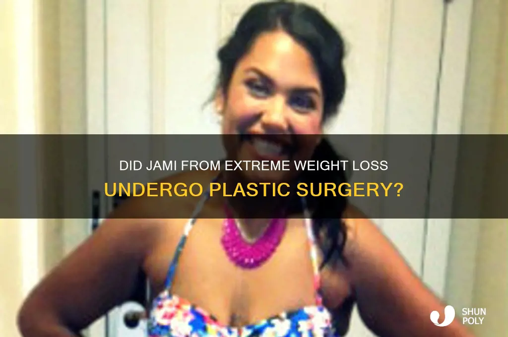 did jami on extreme weight loss show have plastic surgery