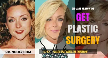 Jane Krakowski's Transformation: Plastic Surgery Rumors Explored