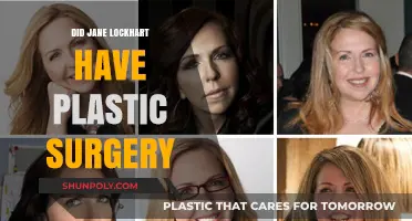 Jane Lockhart's Transformation: Plastic Surgery Rumors Explored and Debunked