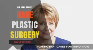 Jane Pauley's Transformation: Plastic Surgery Rumors Explored and Debunked