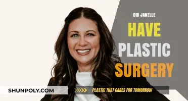 Janelle's Transformation: Unveiling the Truth About Plastic Surgery Rumors