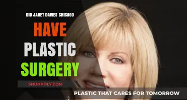 Janet Davies Chicago: Plastic Surgery Speculations and Truths Revealed
