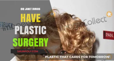 Janet DuBois Plastic Surgery: Unveiling the Truth Behind Her Appearance