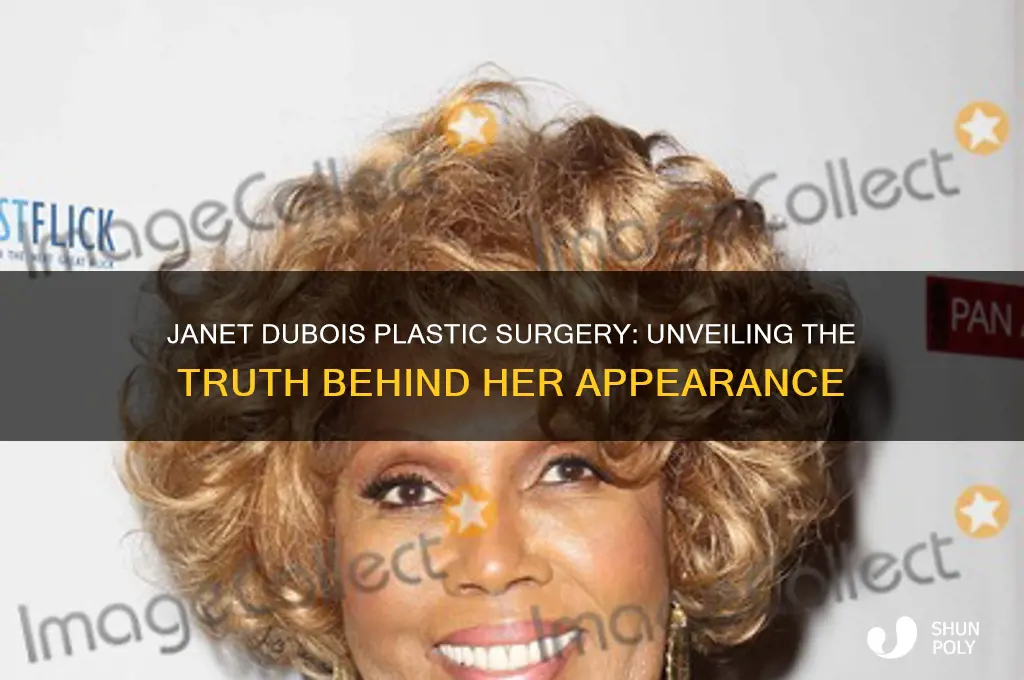 did janet dubois have plastic surgery