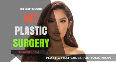 Janet Guzman's Transformation: Plastic Surgery Rumors Explored