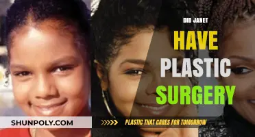 Janet's Transformation: Unveiling the Truth About Her Plastic Surgery