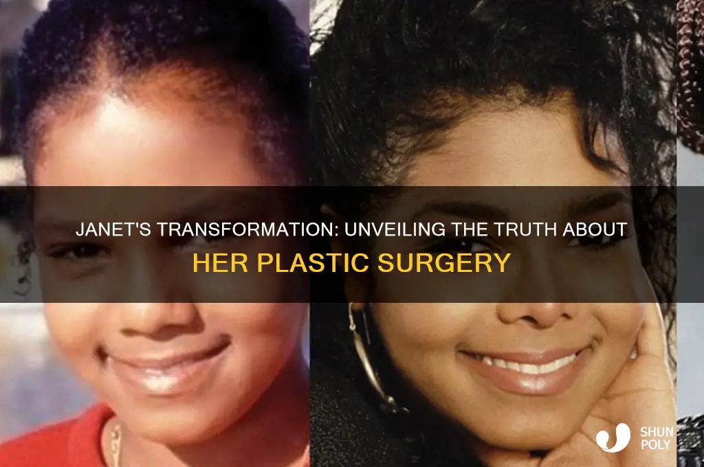 did janet have plastic surgery
