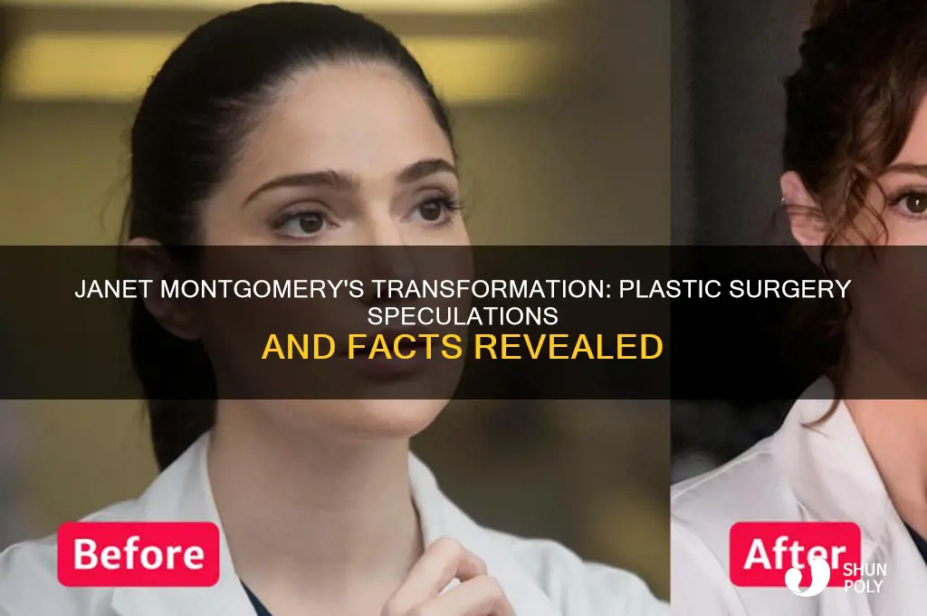 did janet montgomery have plastic surgery