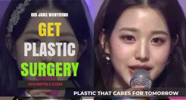 Jang Wonyoung Plastic Surgery Rumors: Fact or Fiction?