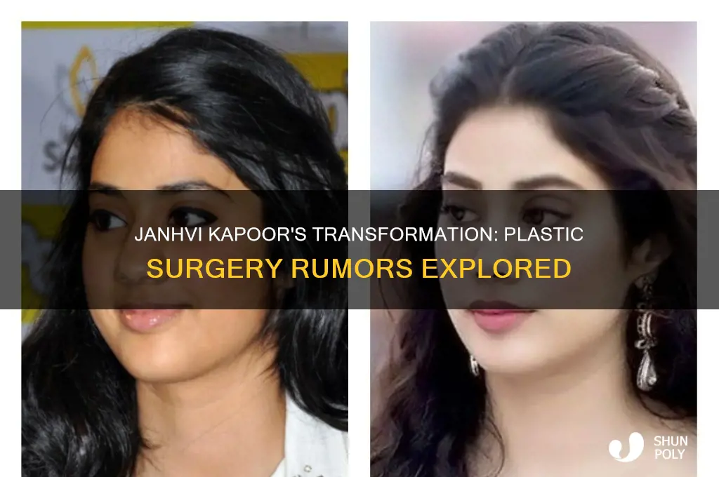did janhvi kapoor get plastic surgery