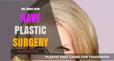 Janice Dean's Transformation: Plastic Surgery Speculations and Facts Revealed