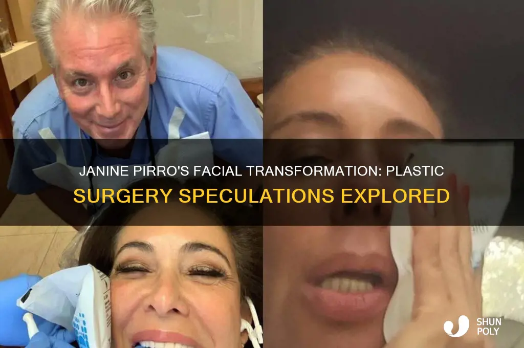 did janine pirro have plastic surgery on her face
