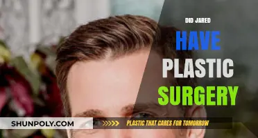 Did Jared Undergo Plastic Surgery? Unveiling the Truth Behind the Rumors