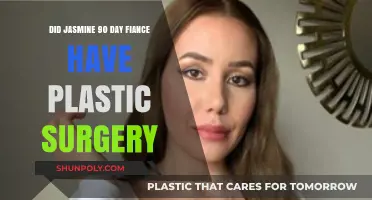 Jasmine's Transformation: Plastic Surgery Speculations on 90 Day Fiancé