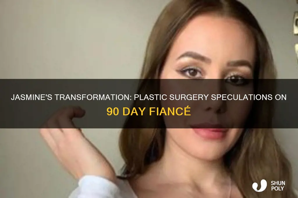 did jasmine 90 day fiance have plastic surgery