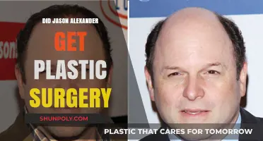 Jason Alexander's Transformation: Plastic Surgery Speculations and Truths