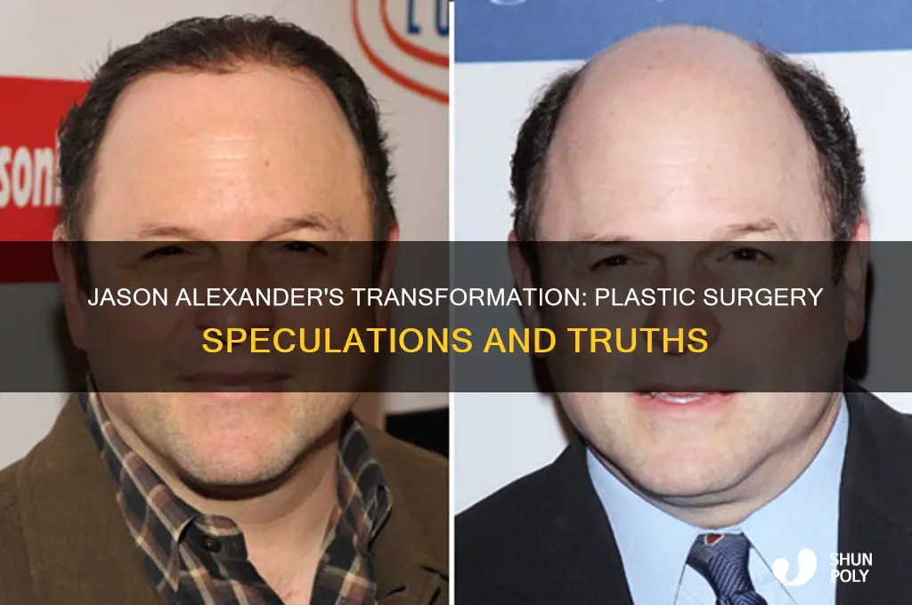 did jason alexander get plastic surgery