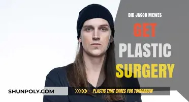 Jason Mewes Plastic Surgery: Fact-Checking the Transformation Rumors