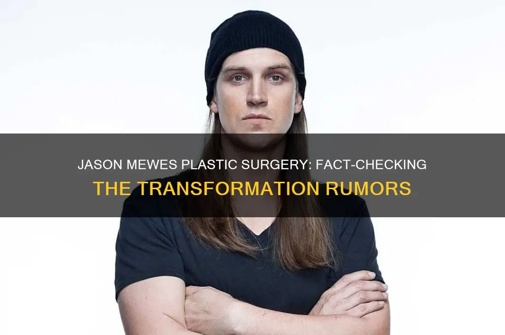 did jason mewes get plastic surgery