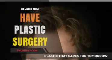 Jason Muse's Transformation: Plastic Surgery Speculations and Facts Revealed