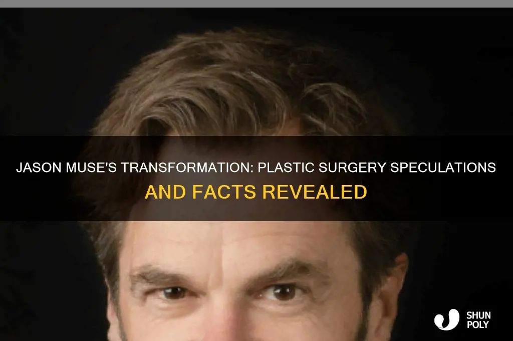 did jason muse have plastic surgery