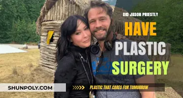 Jason Priestley's Transformation: Plastic Surgery Rumors Explored