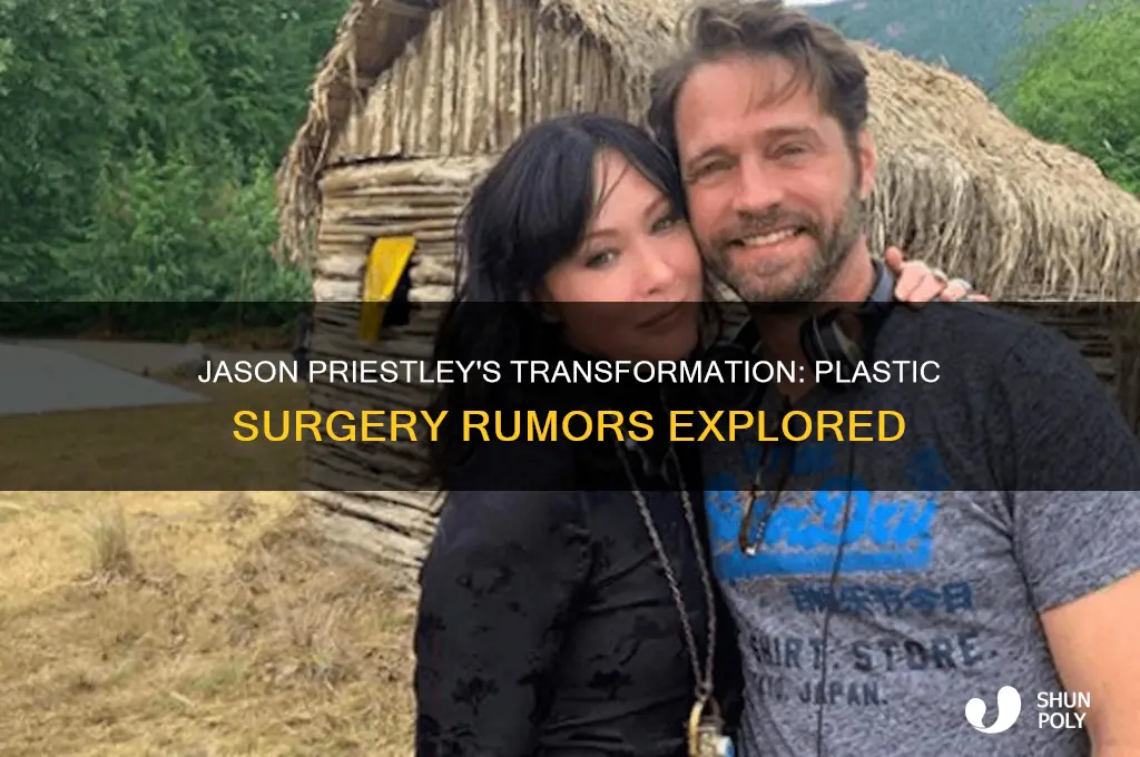 did jason priestly have plastic surgery