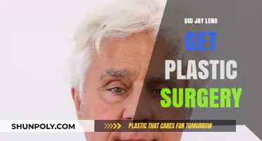 Jay Leno's Transformation: Plastic Surgery Rumors Explored and Debunked
