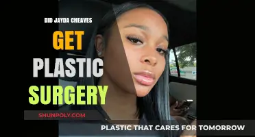 Jayda Cheaves Plastic Surgery: Fact-Checking the Transformation Rumors