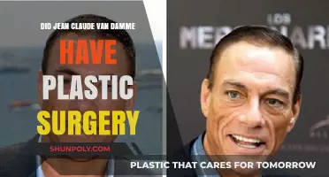 Jean-Claude Van Damme's Transformation: Plastic Surgery Rumors Explored