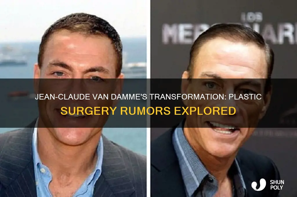 did jean claude van damme have plastic surgery