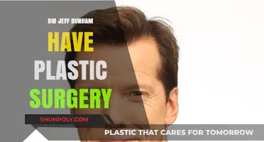 Jeff Dunham's Transformation: Plastic Surgery Rumors Explored and Debunked