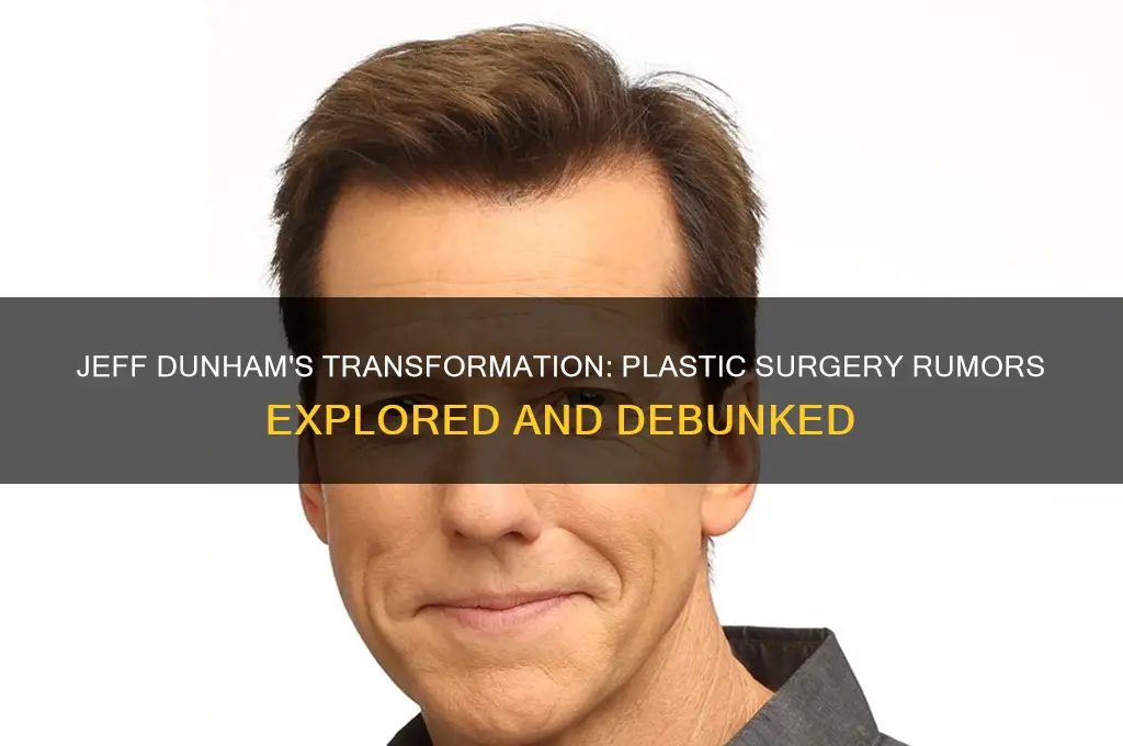did jeff dunham have plastic surgery