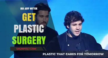 Did Jeff Wittek Undergo Plastic Surgery? Uncovering the Truth