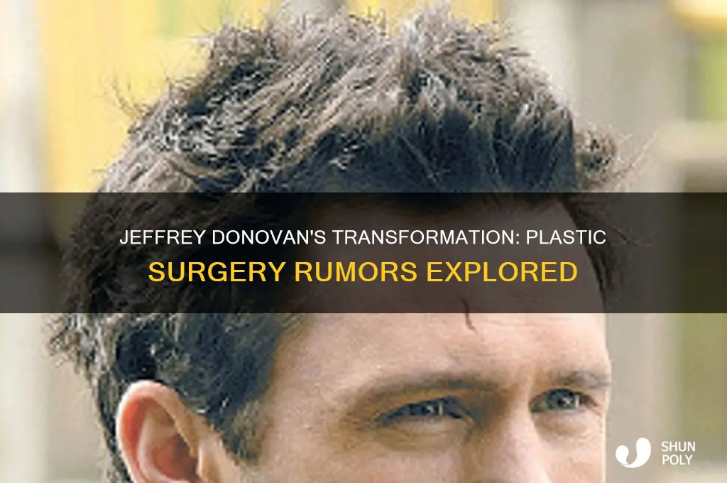 did jeffrey donovan have plastic surgery