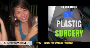 Jelai Andres Plastic Surgery: Fact or Fiction? Unveiling the Truth