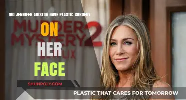 Jennifer Aniston's Face: Natural Beauty or Plastic Surgery?