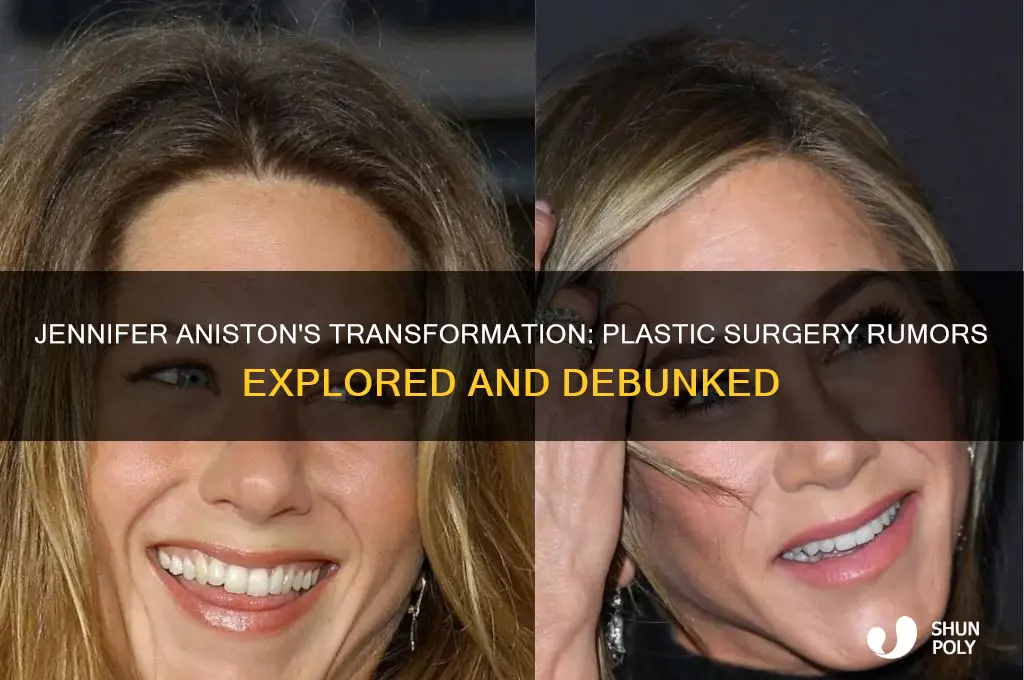 did jennifer anniston get plastic surgery