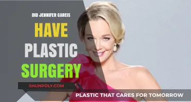 Jennifer Gareis Plastic Surgery: Fact-Checking Rumors and Speculations