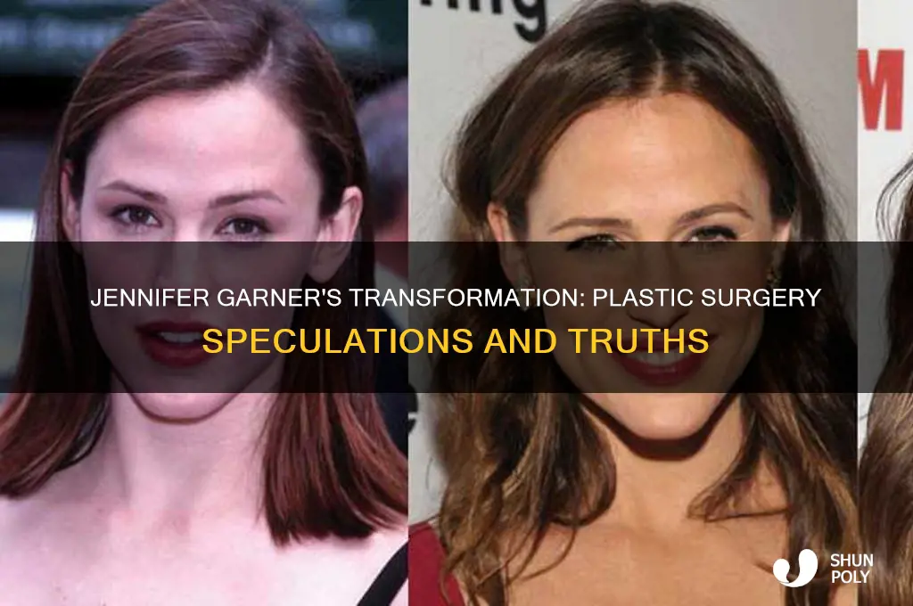 did jennifer garner get plastic surgery