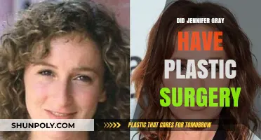 Jennifer Gray's Transformation: Plastic Surgery Rumors and Reality Explored