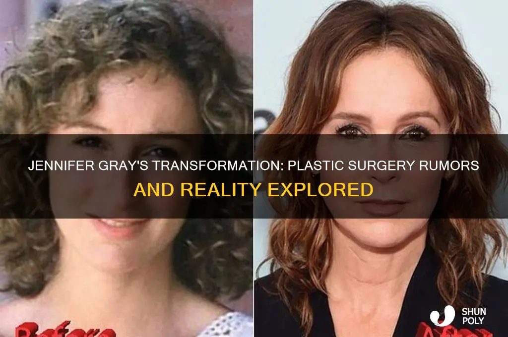 did jennifer gray have plastic surgery