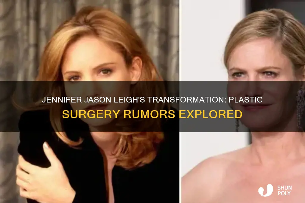 did jennifer jason leigh have plastic surgery