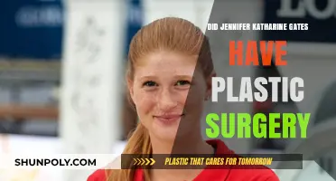 Jennifer Katharine Gates Plastic Surgery: Fact-Checking the Rumors and Speculations