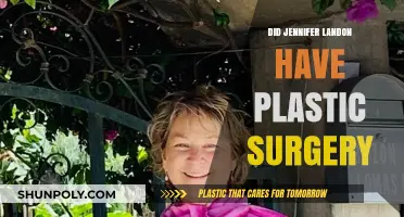 Jennifer Landon's Transformation: Plastic Surgery Speculations and Facts Revealed