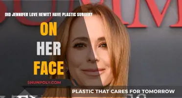 Jennifer Love Hewitt's Face: Natural Beauty or Plastic Surgery?