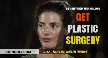 Jenny from The Challenge: Plastic Surgery Speculations and Truths
