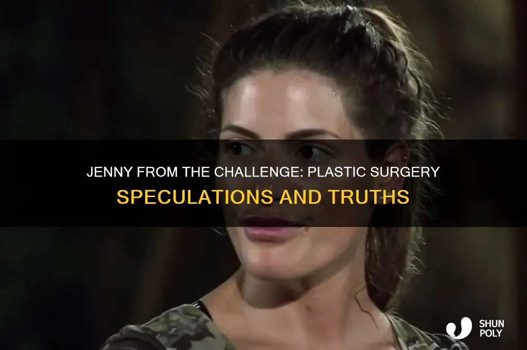 did jenny from the challenge get plastic surgery