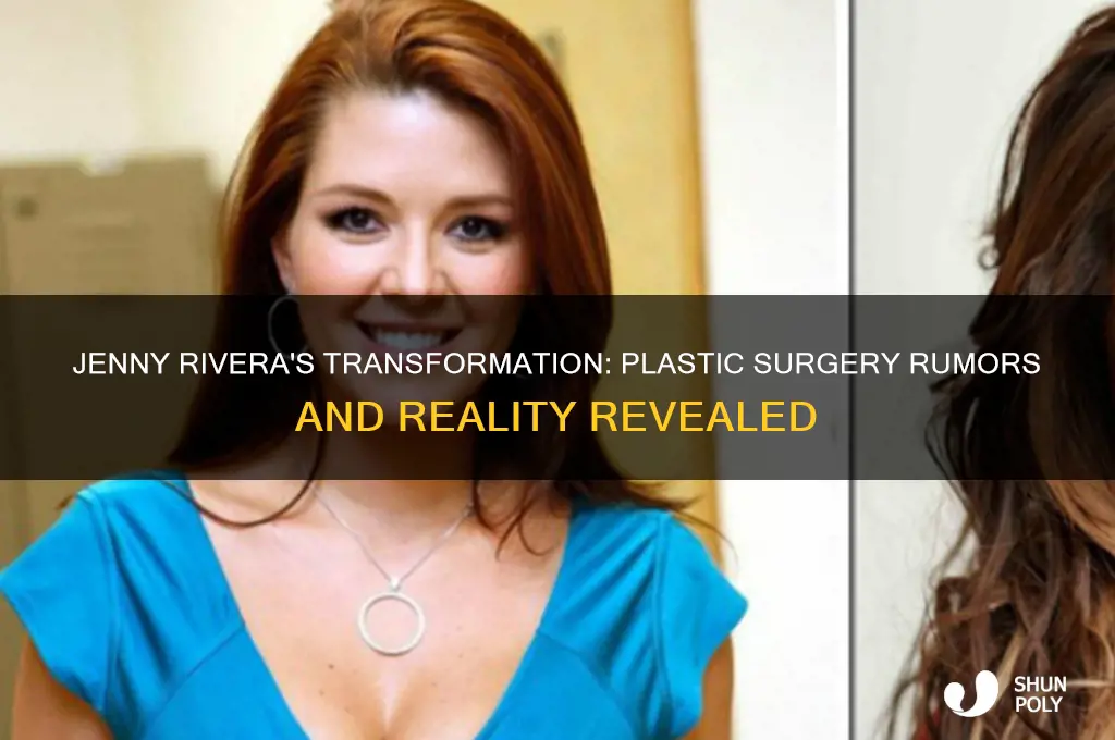 did jenny rivera get plastic surgery
