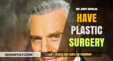 Did Jerry Douglas Undergo Plastic Surgery? Unveiling the Truth